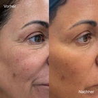 Calcium Volume Multi Balm